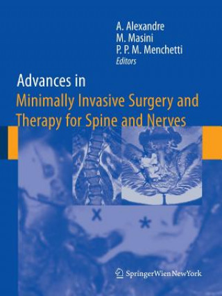 Knjiga Advances in Minimally Invasive Surgery and Therapy for Spine and Nerves Alberto Alexandre