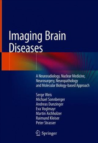 Knjiga Imaging Brain Diseases Serge Weis