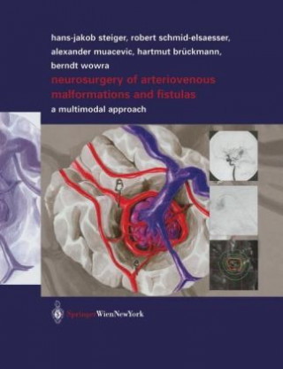 Libro Neurosurgery of Arteriovenous Malformations and Fistulas Robert Schmid-Elsaesser