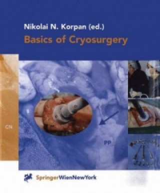 Kniha Basics of Cryosurgery Nikolai N. Korpan