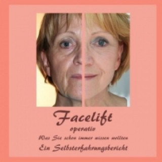 Kniha Facelift operativ Bernhard Siegmund