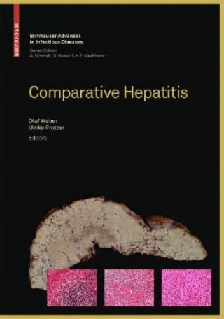 Könyv Comparative Hepatitis Olaf Weber