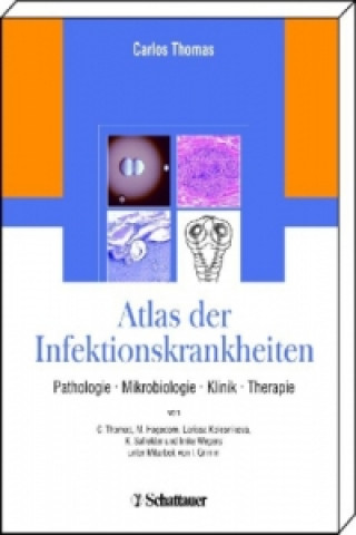 Carte Atlas der Infektionskrankheiten Carlos Thomas