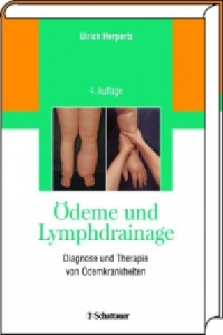 Libro Ödeme und Lymphdrainage Ulrich Herpertz