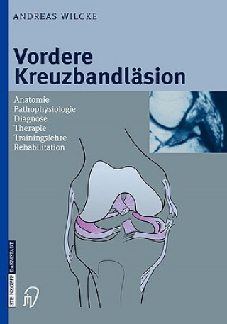 Livre Vordere Kreuzbandlasion Andreas Wilcke