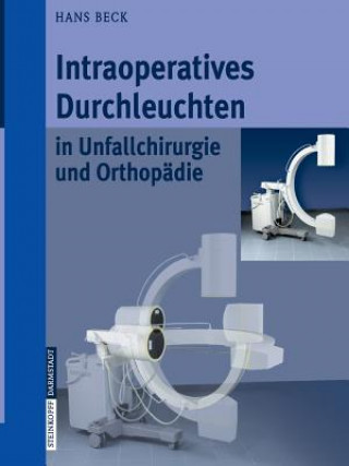 Kniha Intraoperatives Durchleuchten in Unfallchirurgie und Orthopadie Hans Beck