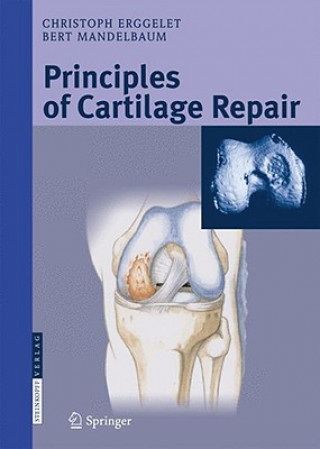 Kniha Principles of Cartilage Repair Christoph Erggelet