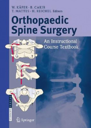 Knjiga Orthopaedic Spine Surgery Wolfram Käfer