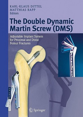 Knjiga Double Dynamic Martin Screw (DMS) Karl-Klaus Dittel