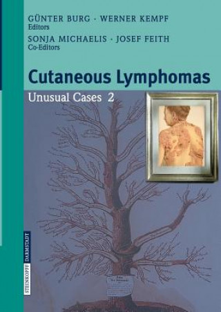 Книга Cutaneous Lymphomas Günter Burg