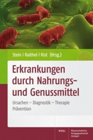 Kniha Erkrankungen durch Nahrungs- und Genussmittel Jürgen Stein