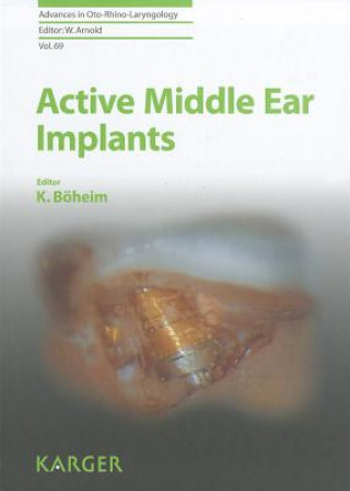 Книга Active Middle Ear Implants K. Boeheim