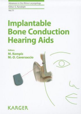 Könyv Implantable Bone Conduction Hearing Aids Martin Kompis