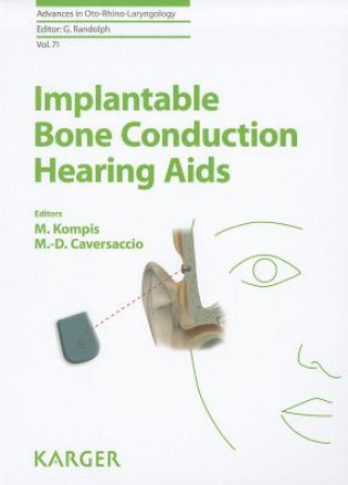 Libro Implantable Bone Conduction Hearing Aids Martin Kompis