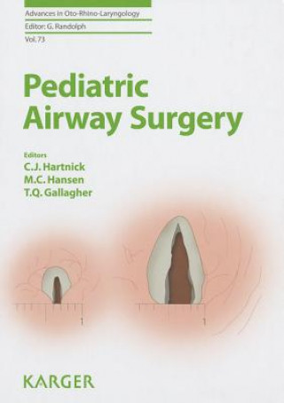 Carte Pediatric Airway Surgery artnick
