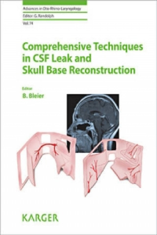 Kniha Comprehensive Techniques in CSF Leak Repair and Skull Base Reconstruction leier