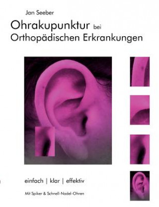 Book Ohrakupunktur bei Orthopadischen Erkrankungen Jan Seeber