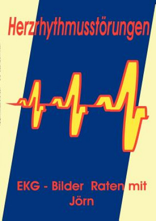 Book Herzrhythmusstoerungen Jörn Nickoleit