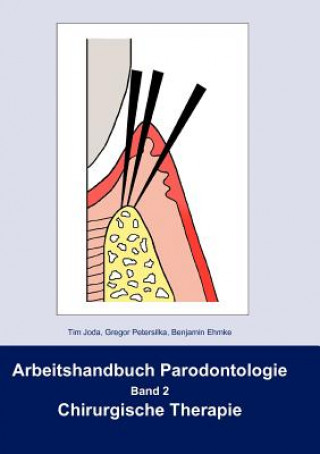 Knjiga Arbeitshandbuch Parodontologie Tim Joda