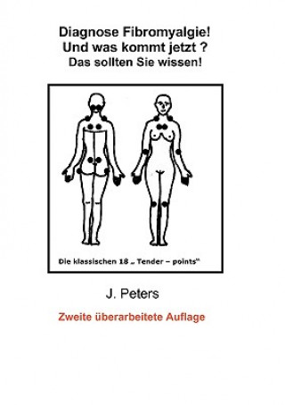 Libro Diagnose Fibromyalgie! Und was kommt jetzt? Joachim Peters