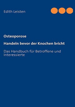 Kniha Osteoporose Edith Leisten