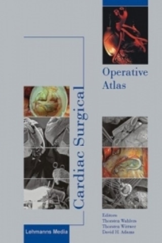 Книга Cardiac Surgical Operative Atlas Thorsten Wahlers