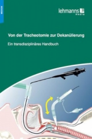 Kniha Von der Tracheotomie zur Dekanülierung 