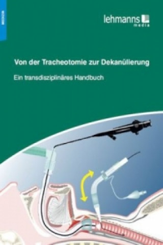 Libro Von der Tracheotomie zur Dekanülierung 