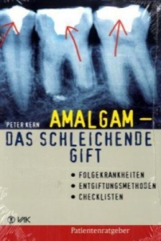 Kniha Amalgam - das schleichende Gift Peter Kern