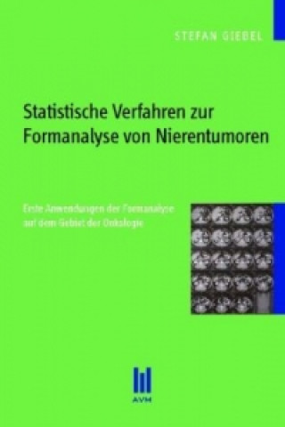 Kniha Statistische Verfahren zur Formanalyse von Nierentumoren Stefan Giebel