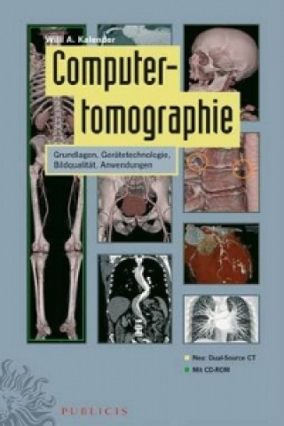 Kniha Computertomographie Willi A. Kalender