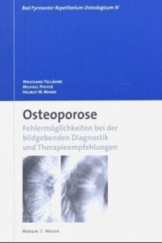 Kniha Osteoporose Wolfgang Pollähne