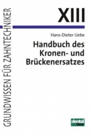 Kniha Handbuch des Kronen- und Brückenersatzes Hans-Dieter Uebe