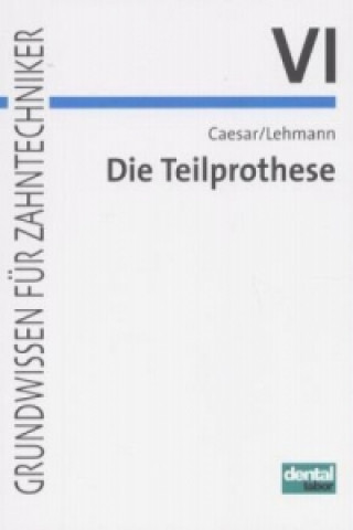 Kniha Die Teilprothese Hans H. Caesar