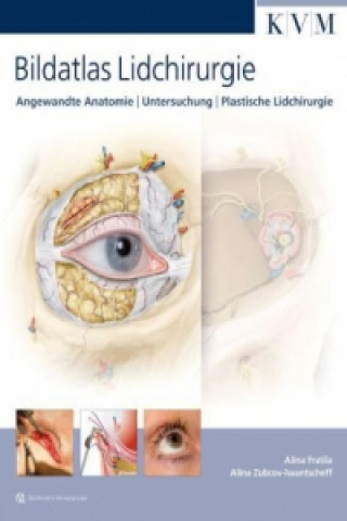 Knjiga Bildatlas Lidchirurgie Alina Fratila