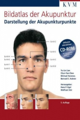 Книга Bildatlas der Akupunktur, m. CD-ROM Yu-Lin Lian