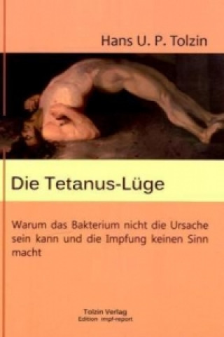 Kniha Die Tetanus-Lüge Hans U. P. Tolzin