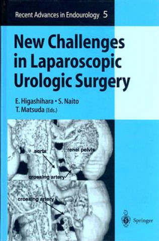 Kniha New Challenges in Laparoscopic Urologic Surgery E. Higashihara