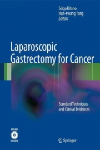 Carte Laparoscopic Gastrectomy for Cancer Seigo Kitano