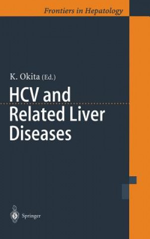 Carte HCV and Related Liver Diseases Kiwamu Okita
