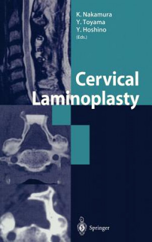 Książka Cervical Laminoplasty K. Nakamura