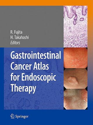 Knjiga Gastrointestinal Cancer Atlas for Endoscopic Therapy Rikiya Fujita