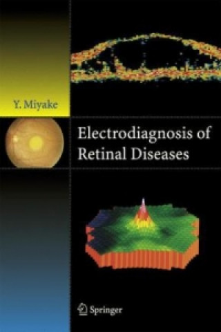 Kniha Electrodiagnosis of Retinal Disease Yozo Miyake