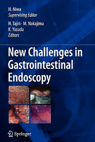 Kniha New Challenges in Gastrointestinal Endoscopy Hisao Tajiri