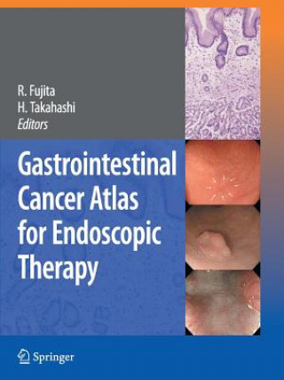 Book Gastrointestinal Cancer Atlas for Endoscopic Therapy Rikiya Fujita