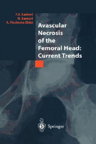 Kniha Avascular Necrosis of the Femoral Head: Current Trends F. S. Santori