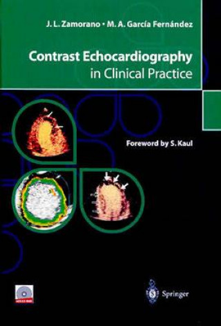 Carte Contrast Echocardiography in Clinical Practice, w. CD-ROM J. L. Zamorano
