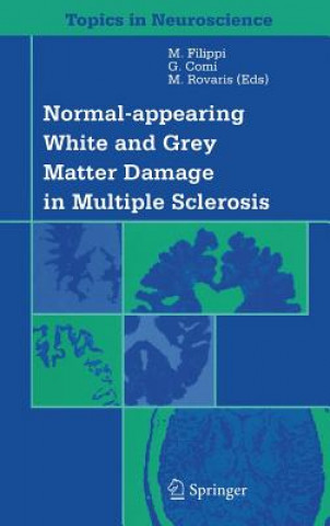 Książka Normal-appearing White and Grey Matter Damage in Multiple Sclerosis M. Filippi