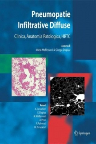 Könyv Pneumopatie Infiltrative Diffuse M. Maffessanti