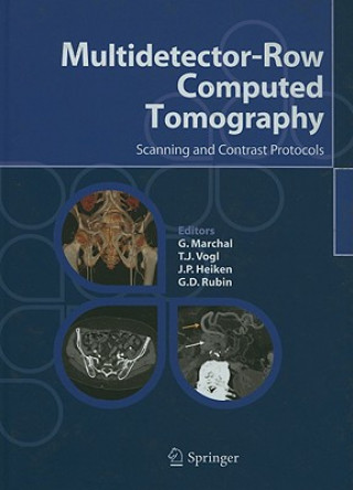 Könyv Multidetector-Row Computed Tomography G. Marchal